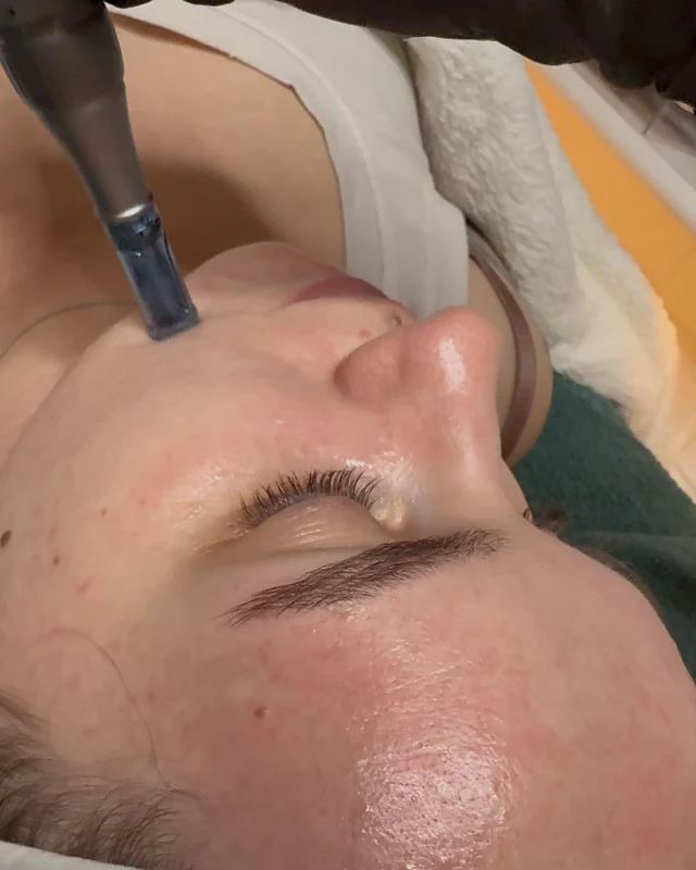 ✨ REAL SKIN TRANSFORMATION. PRIVATE STUDIO MAGIC! ✨

Ever wondered what 1:1 expert care can do for your skin? 
Meet Chloe; She arrived feeling frustrated by crowded salons and sensitive skin—now she glows with confidence after her bespoke treatment journey.

Her story is just one of many. Every visit is private, personal, and guided by 25 years of experience.

Ready to see your own transformation? Message me to book your exclusive session today!

#skincarejourney #beforeandafter #privateskincarestudio #expertcare #localbusiness #clienttestimonial #glowingskin #1on1care #skincareroutine #beautytransformation #supportlocal #selfcare
